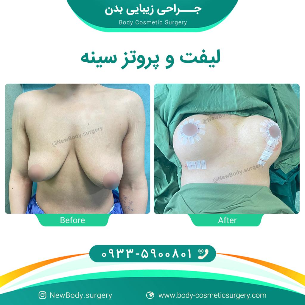 دکتر سلیمانی | جراحی زیبایی بدن