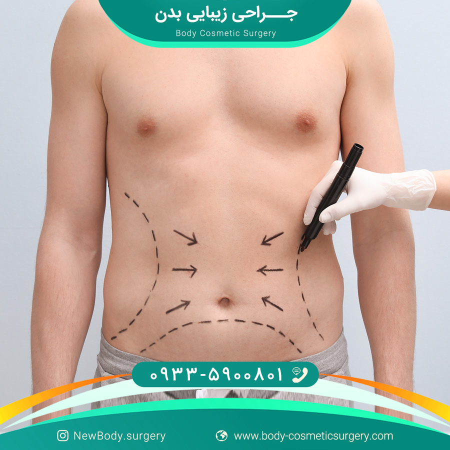 جراحی زیبایی بدن