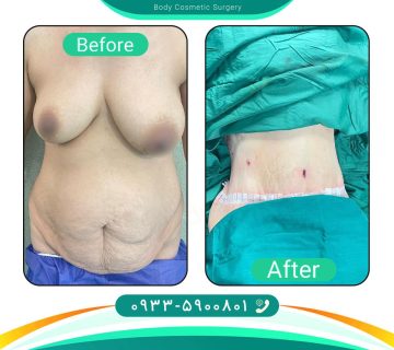 دکتر سلیمانی | جراحی زیبایی بدن