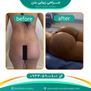 بهترین جراح پلاستیک در تهران