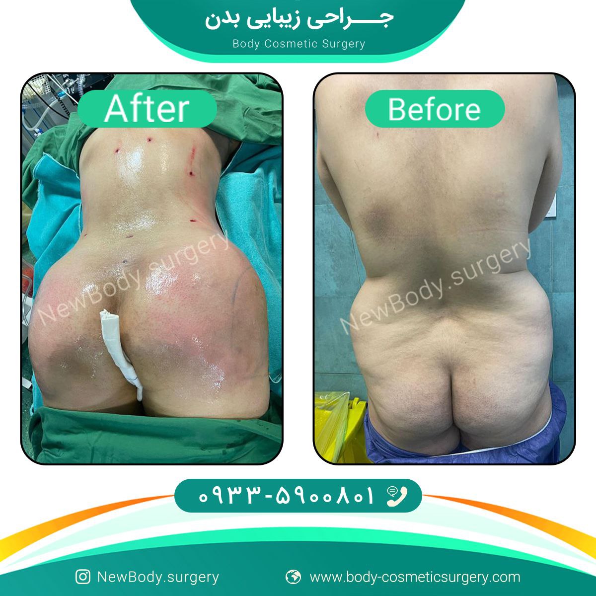 دکتر سلیمانی | جراحی زیبایی بدن