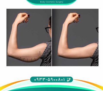 دکتر سلیمانی | جراحی زیبایی بدن