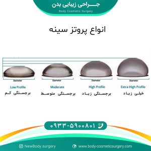 انواع پروتز سینه