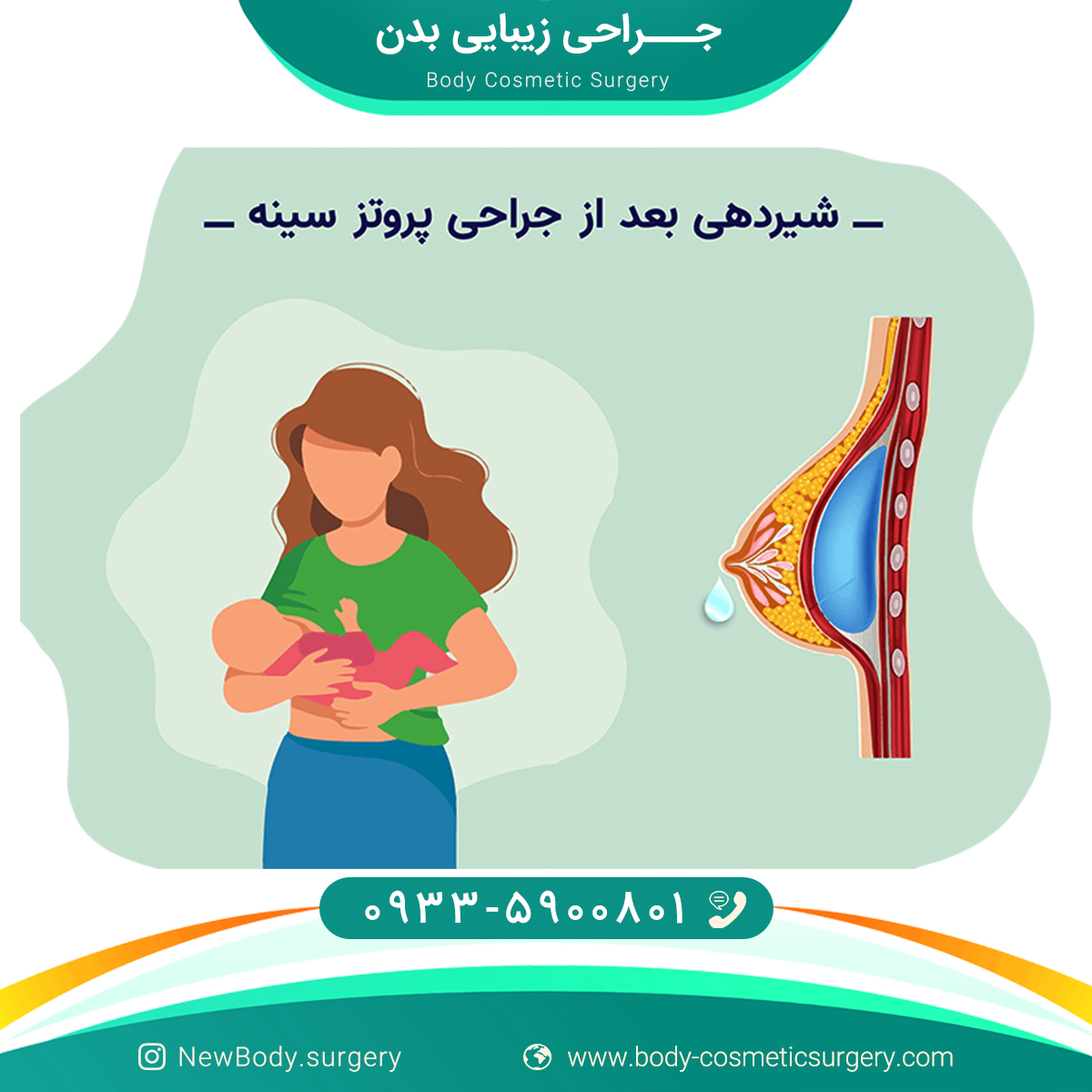 جراحی زیبایی بدن