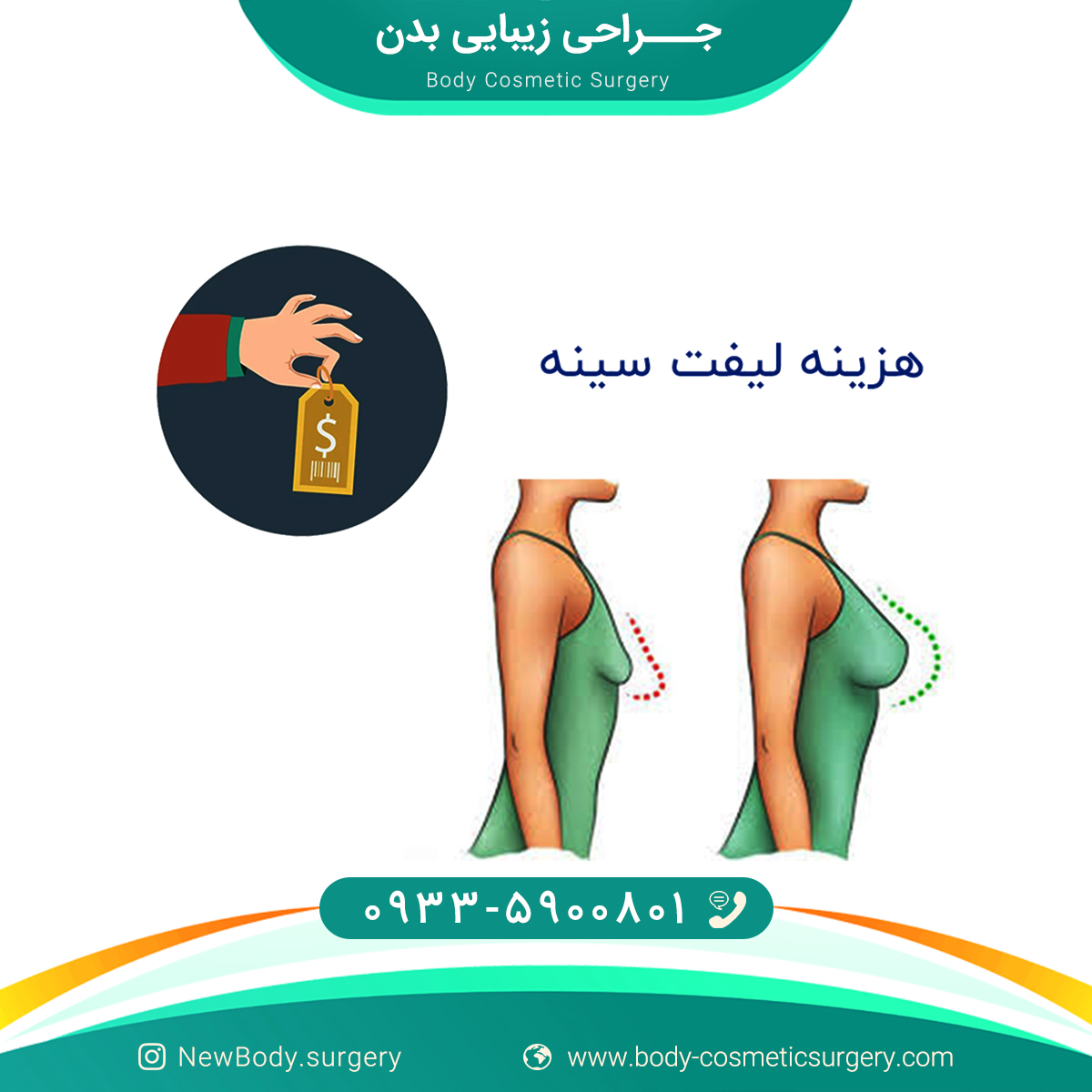 جراحی زیبایی بدن