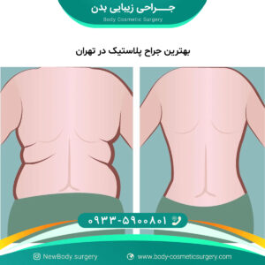 بهترین جراح پلاستیک در تهران