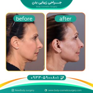 جراحی زیبایی بدن