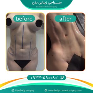 جراحی زیبایی بدن در تهران