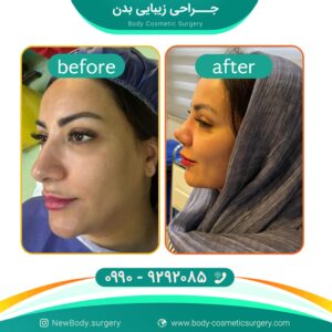 بهترین جراح بینی در تهران